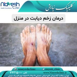 درمان زخم دیابت در منزل