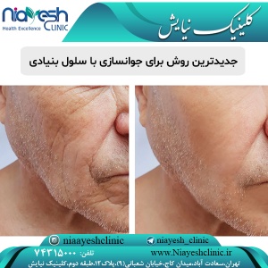 سلول بنیادی برای پوست