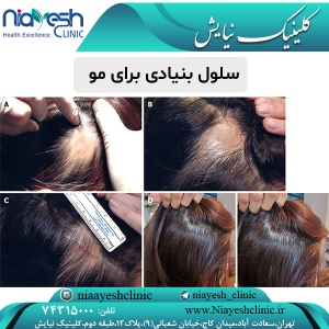 سلول بنیادی برای مو